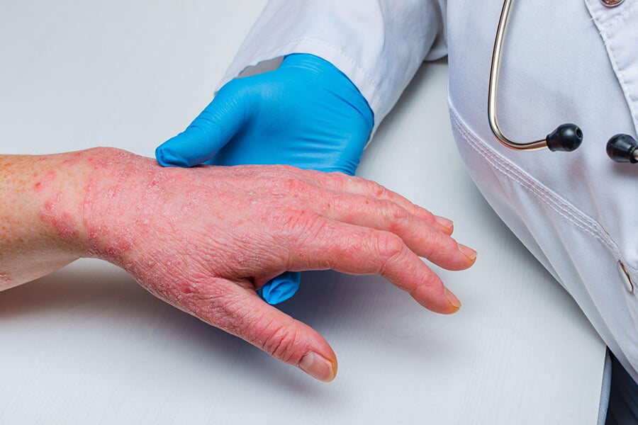 Traitements Dermatologiques