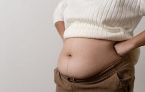 la chirurgie de perte de poids en turquie est elle sure